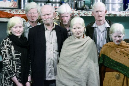 Самая большая семья альбиносов в мире (2 фото + видео)