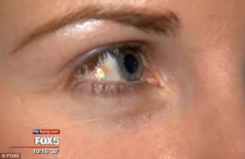 Женщина имплантировала себе в глаз платиновое украшение, чтобы прибавить себе уникальности (2 фото + видео)