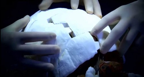 Черепаха Фредди с первым в мире карапаксом, напечатанным на 3D-принтере (6 фото + видео)