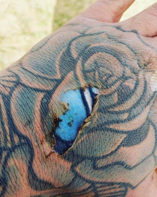 Фото яркой татуировки под кожей в месте ожога вызвали ожесточенные споры в сети (2 фото)