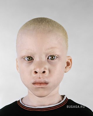 Люди-альбиносы