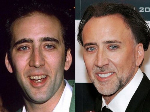 Звезды до и после стоматолога