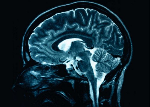 10 фактов о человеческом мозге
