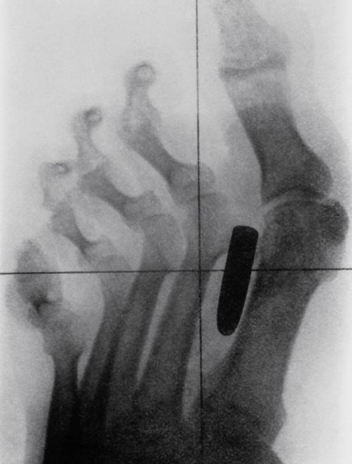 Шокирующие рентгеновские снимки