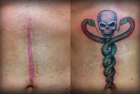 12 Самых прикольных татуировок, сделанных чтобы замаскировать шрамы