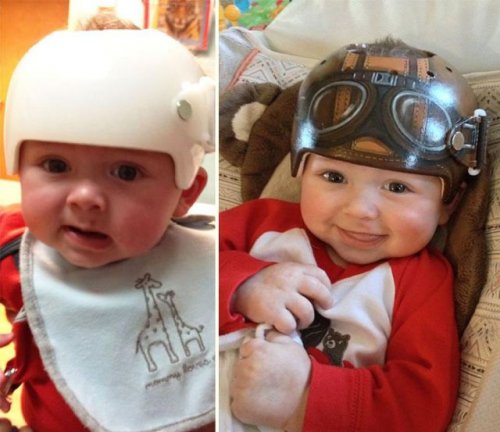 Художница разрисовывает медицинские формирующие шлемы для малышей (26 фото)
