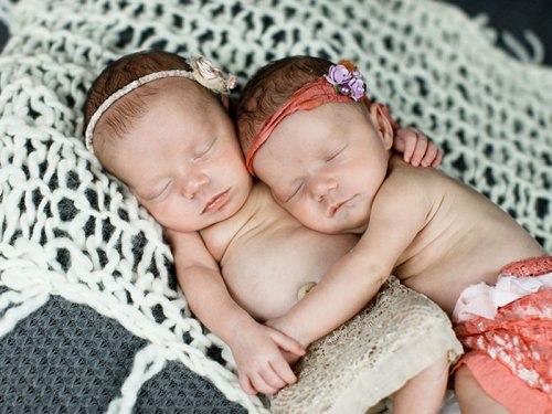 Родившиеся практически за руки близняшки спустя 2 года стали неразлучны (7 фото)
