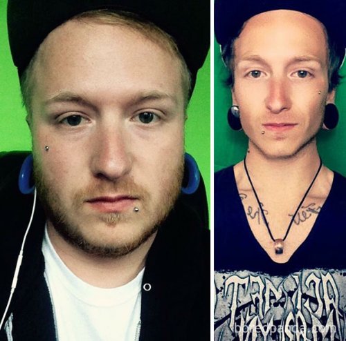 Сравнительные фотографии людей до и после того, как они перестали пить (23 фото)