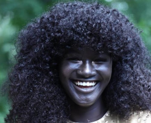 Уникальные люди с необычным цветом кожи (7 фото)
