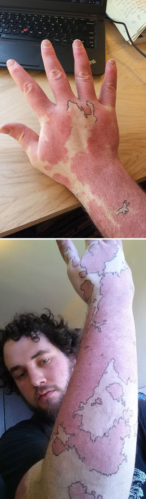 Кавер-ап тату, умело обыгрывающие и скрывающие родимые пятна (37 фото)