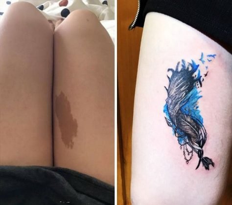 Кавер-ап татуировки, скрывающие родимые пятна (23 фото)