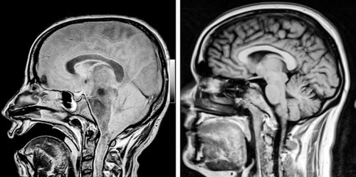 11 рентгеновских снимков и сканов, которые расскажут о человеческом организме интереснее, чем в учебниках