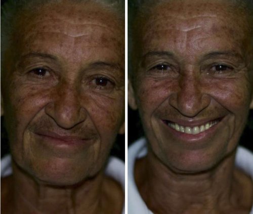 Бразильский стоматолог путешествует по миру, даря бедным людям улыбки, веру в себя и надежду на будущее (25 фото)