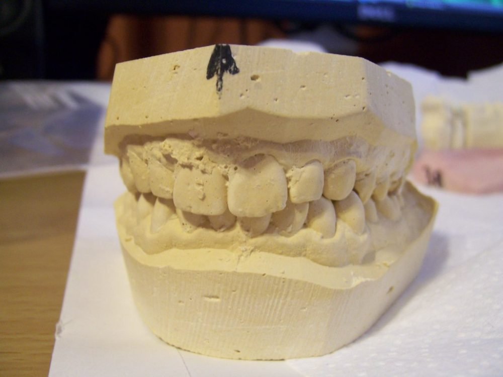 Почему скрипит сыр. Каждый комплект зубов – уникален. Сыр скрипит на зубах. Вставные зубы Джорджа Вашингтона.