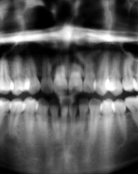 ТОП-25: Удивительные факты о зубах, которые являются правдой