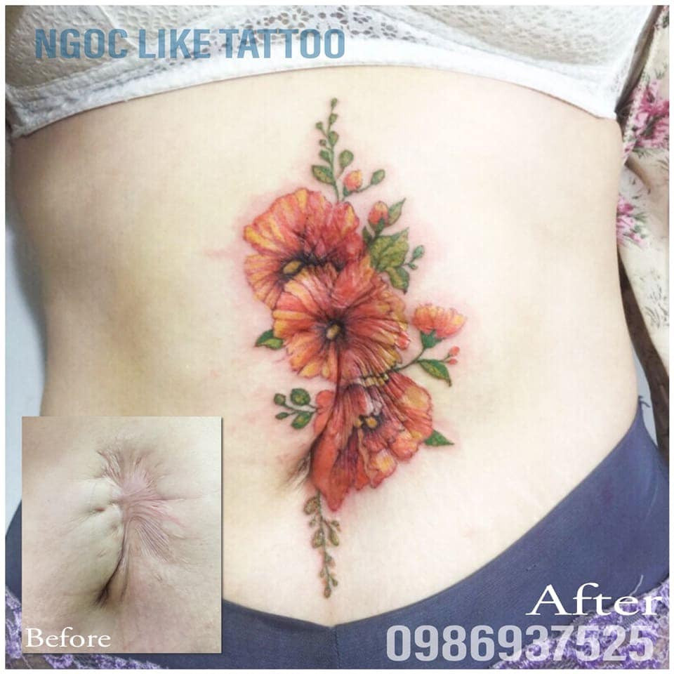 Татуировки на шрамах на животе для женщин фото