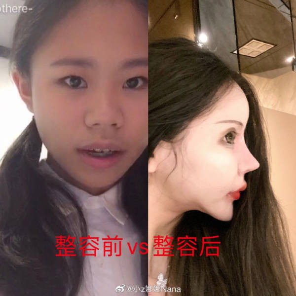Китайская школьница перенесла почти сотню пластических операций, чтобы стать похожей на куклу (6 фото)
