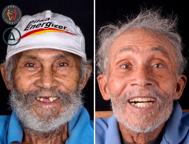 Бразильский стоматолог путешествует, чтобы лечить зубы людей, у которых на это нет денег (26 фото)