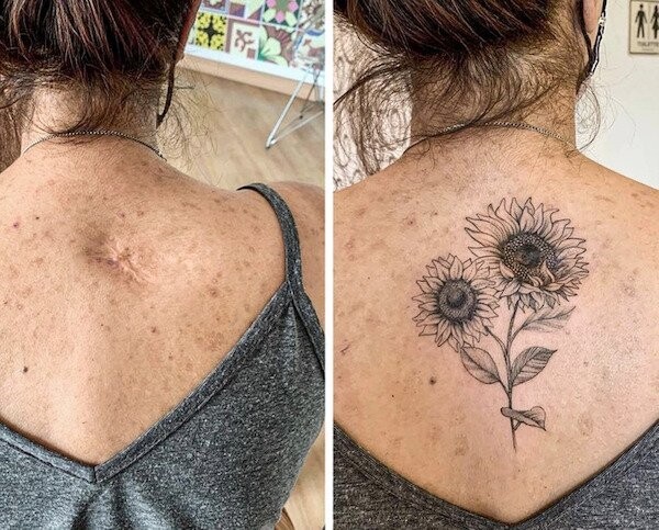 19 раз, когда с помощью татуировок изъяны кожи превратили с украшение