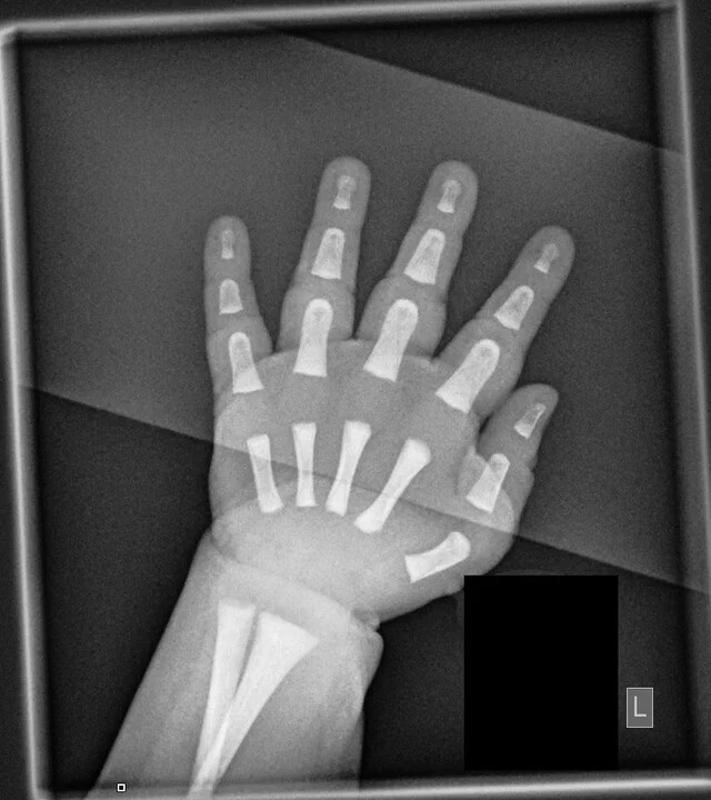 15 раз, когда люди делали рентгеновские снимки и получали интересные результаты