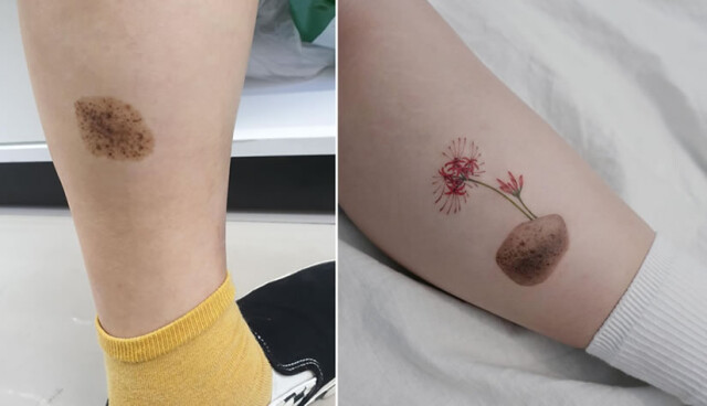 Кавер-ап татуировки, с помощью которых мастера превращают недостатки кожи в произведения искусства (24 фото)