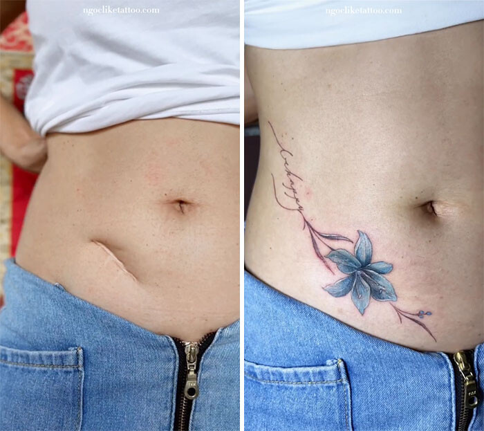 Вьетнамская татуировщица прячет уродующие шрамы за красивыми татуировками, помогая женщинам вернуть уверенность в себе (28 фото)