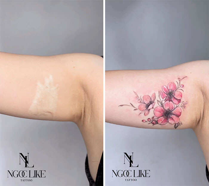 Вьетнамская татуировщица прячет уродующие шрамы за красивыми татуировками, помогая женщинам вернуть уверенность в себе (28 фото)