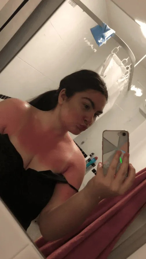 Смешные примеры неудачного загара (16 фото)